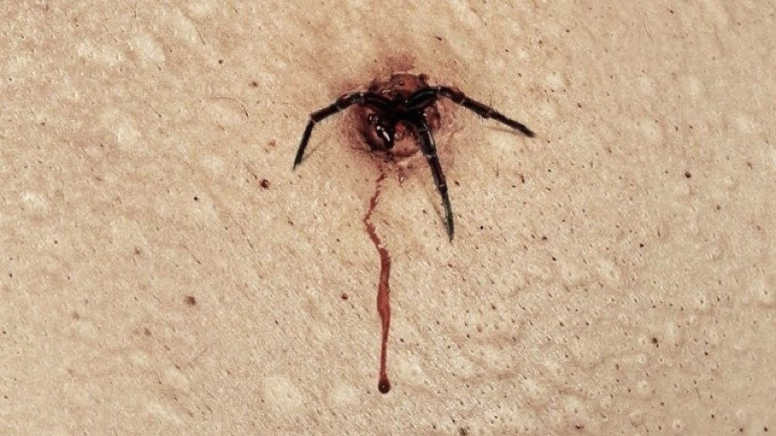 The Plague